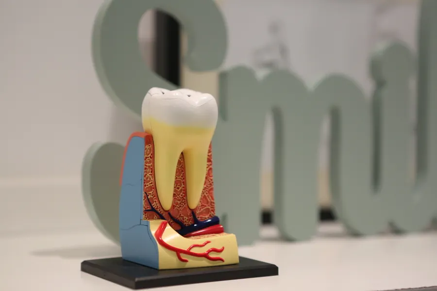 Tooth model used to explain implant planning and aftercare for patients in China - QGO Medical