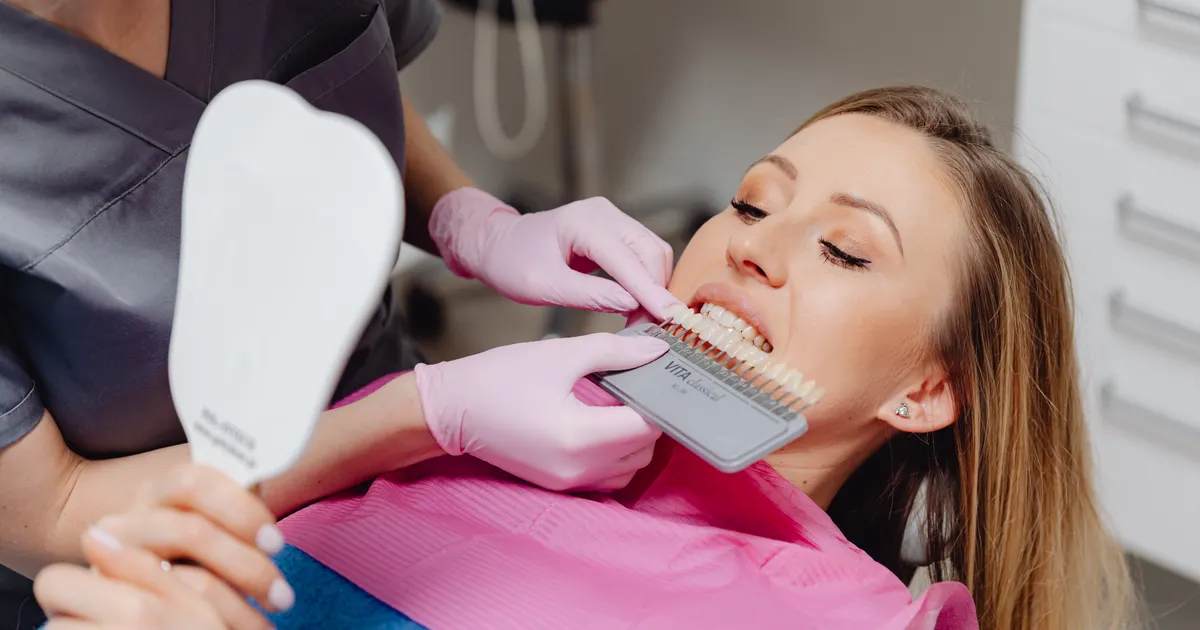 Cosmetic dental bonding shade matching consultation in China - QGO Medical