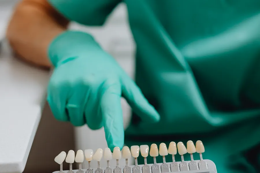 Dentist holding a dental shade guide for cosmetic bonding planning in China - QGO Medical