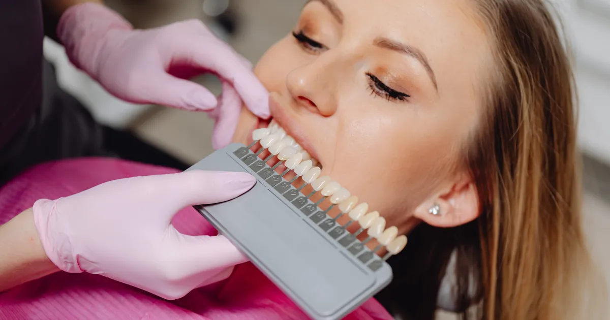 Dental bonding near me shade matching consultation in China - QGO Medical