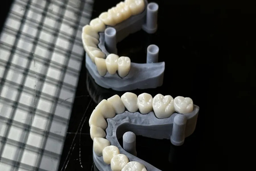 Dental models used for bonding and veneer planning in China - QGO Medical