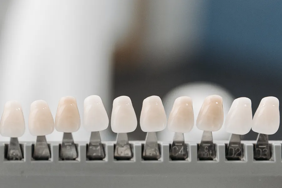 Dental veneer shade guide close-up used for material and color planning in China - QGO Medical